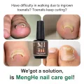 Left Up Gel