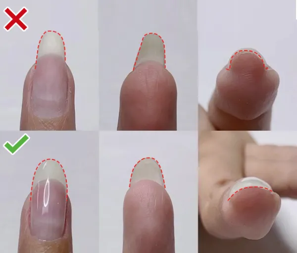 Left Up Gel